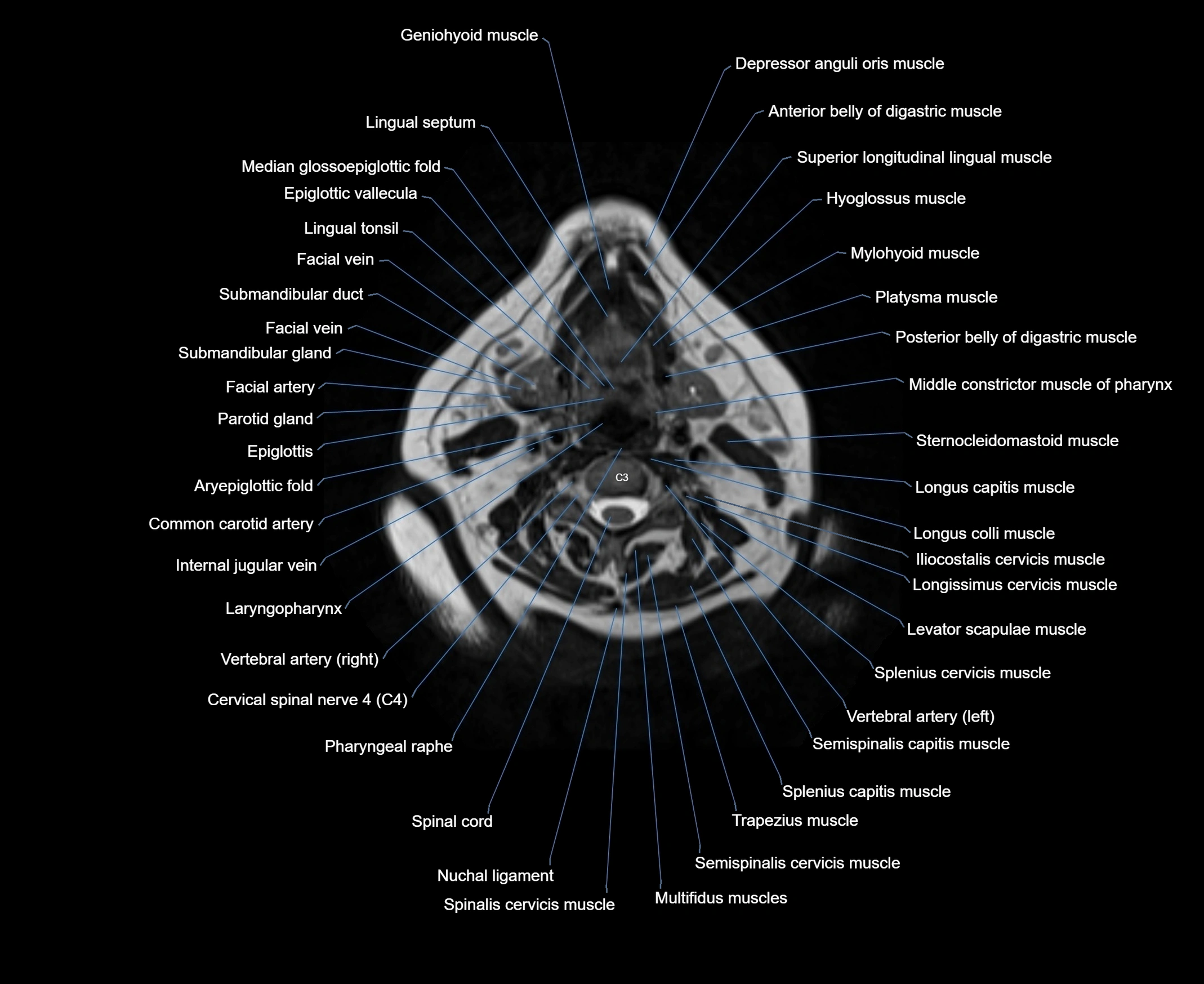 MRI Neck 3D labelled cross section anatomy axial 3t image-00001-00047.webp